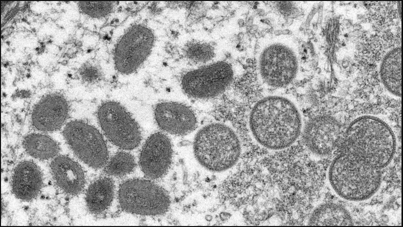 La viruela símica en el microscopio.
