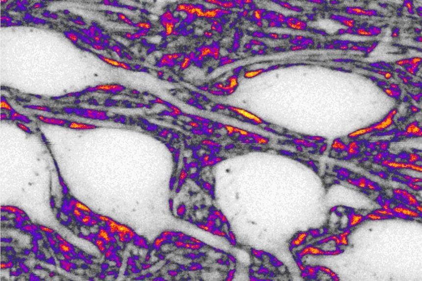 La OMS sin fondos, el cerebro que se "recablea" y el cáncer que ya no siempre mata: los grandes temas de salud que el mundo discute hoy